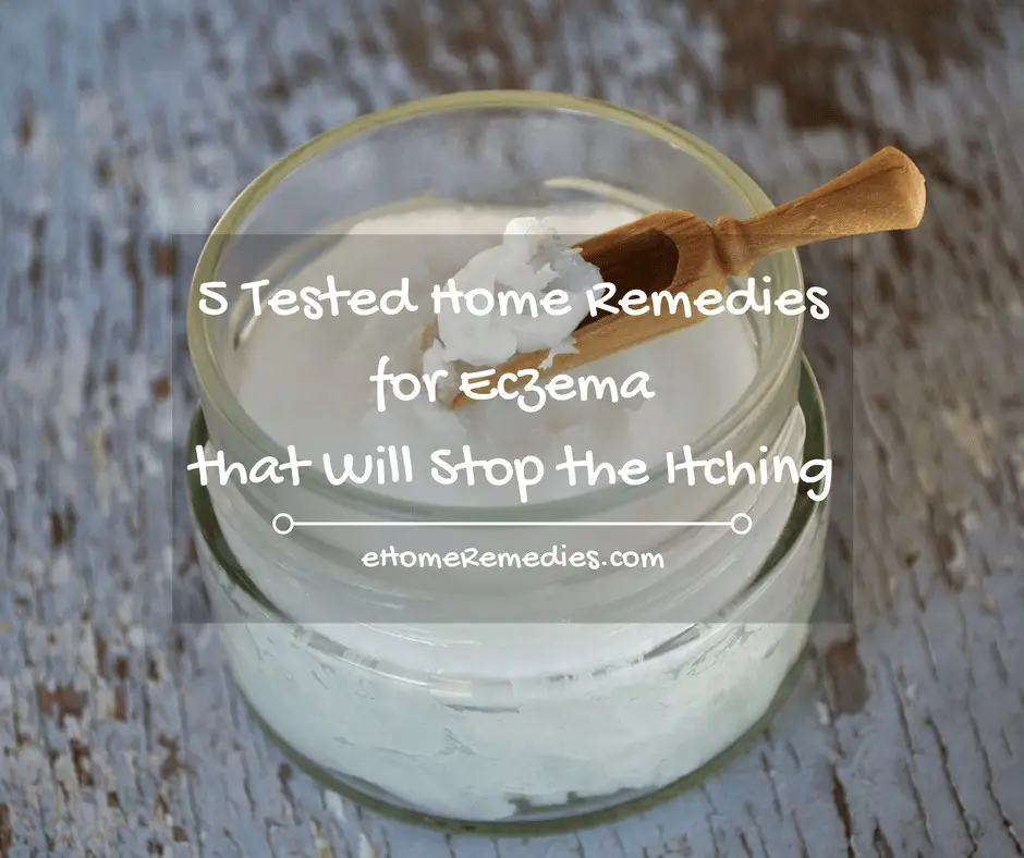 5 Tested Home Remedies for Eczema that Will Stop the Itching